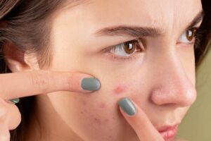 Skin, Hair, And Nail problems that require the help of a Dermatologist