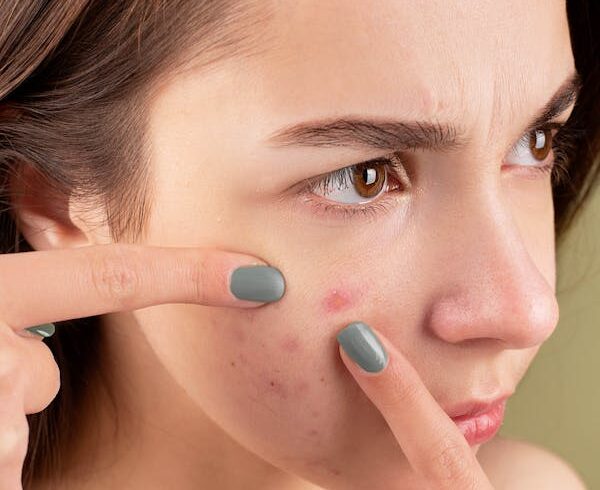 Skin, Hair, And Nail problems that require the help of a Dermatologist